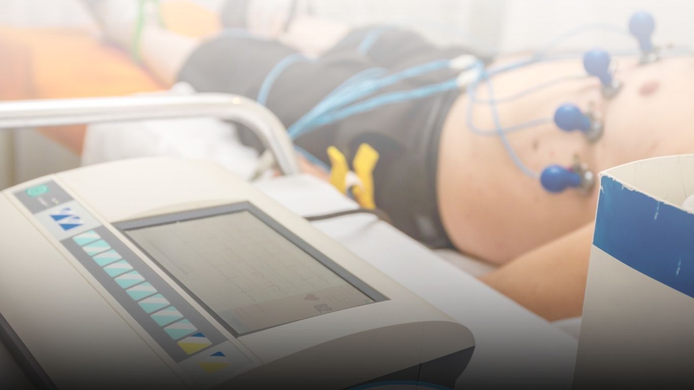 Apakah EKG Jantung Ditanggung BPJS? Ini Penjelasan Lengkapnya