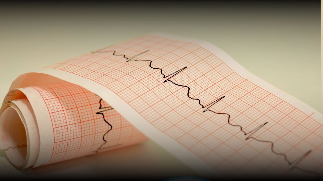 Dokter melakukan pemeriksaan EKG untuk mengevaluasi aktivitas listrik jantung di Klinik Ratnasari Sehat Kabupaten Bandung.