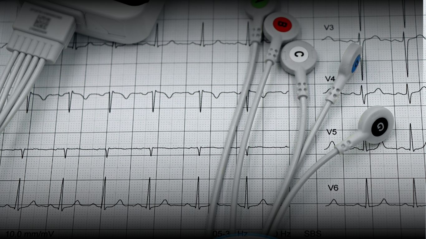 Dokter melakukan pemeriksaan EKG di Klinik Ratnasari Sehat Kabupaten Bandung