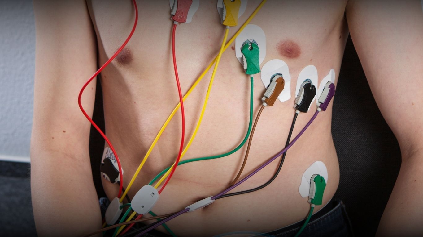 Pemeriksaan EKG dengan BPJS